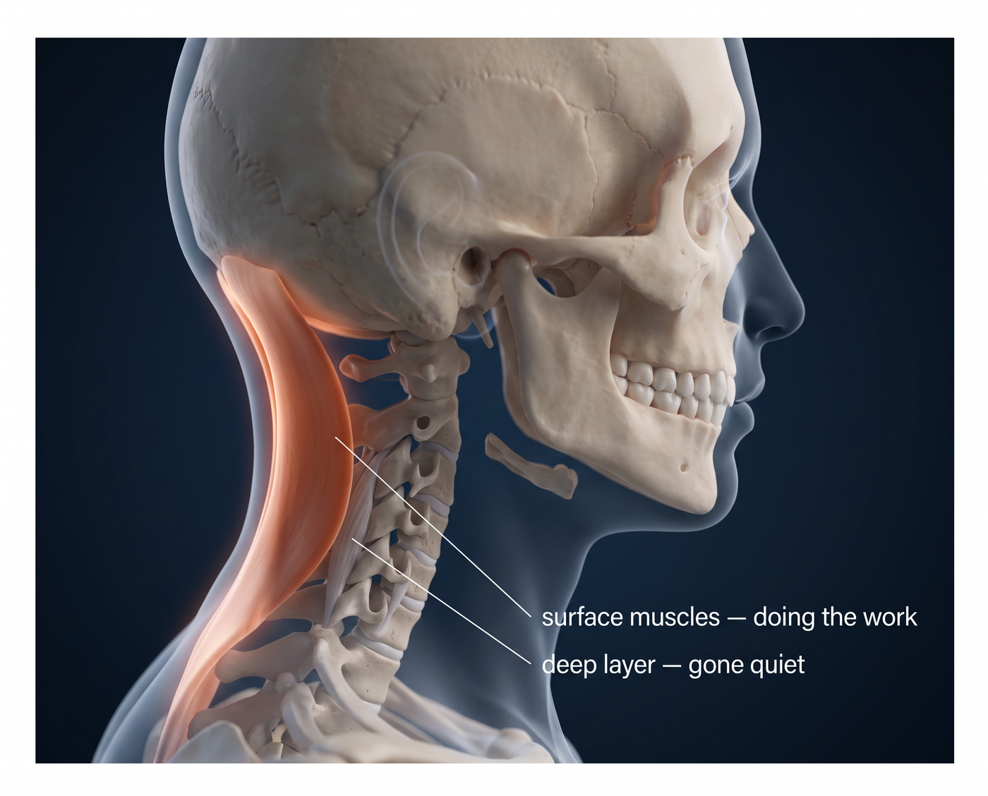 Anatomical illustration of the neck showing surface muscles doing the work and a deep layer gone quiet